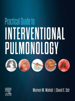 cover image of Practical Guide to Interventional Pulmonology E-Book